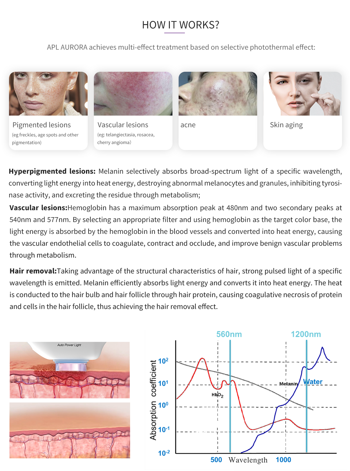 APL怎么工作英文版 APL怎么工作英文版